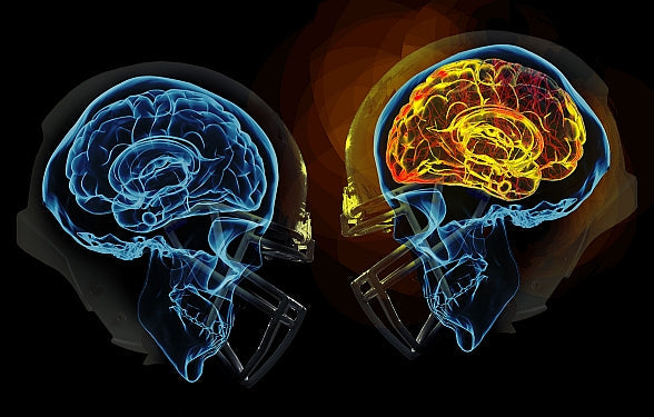 What is CTE & how can it be diagnosed?